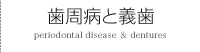 歯周病と義歯