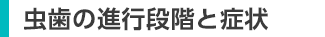 虫歯の進行段階と症状